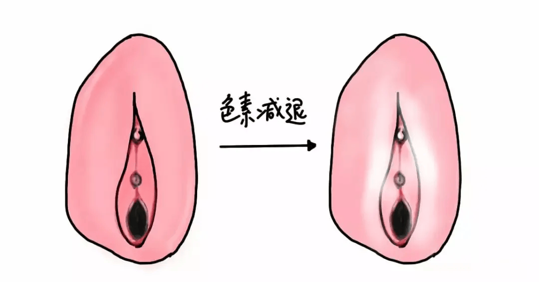 昆明良方外阴白斑研究中心能报医保吗多少钱