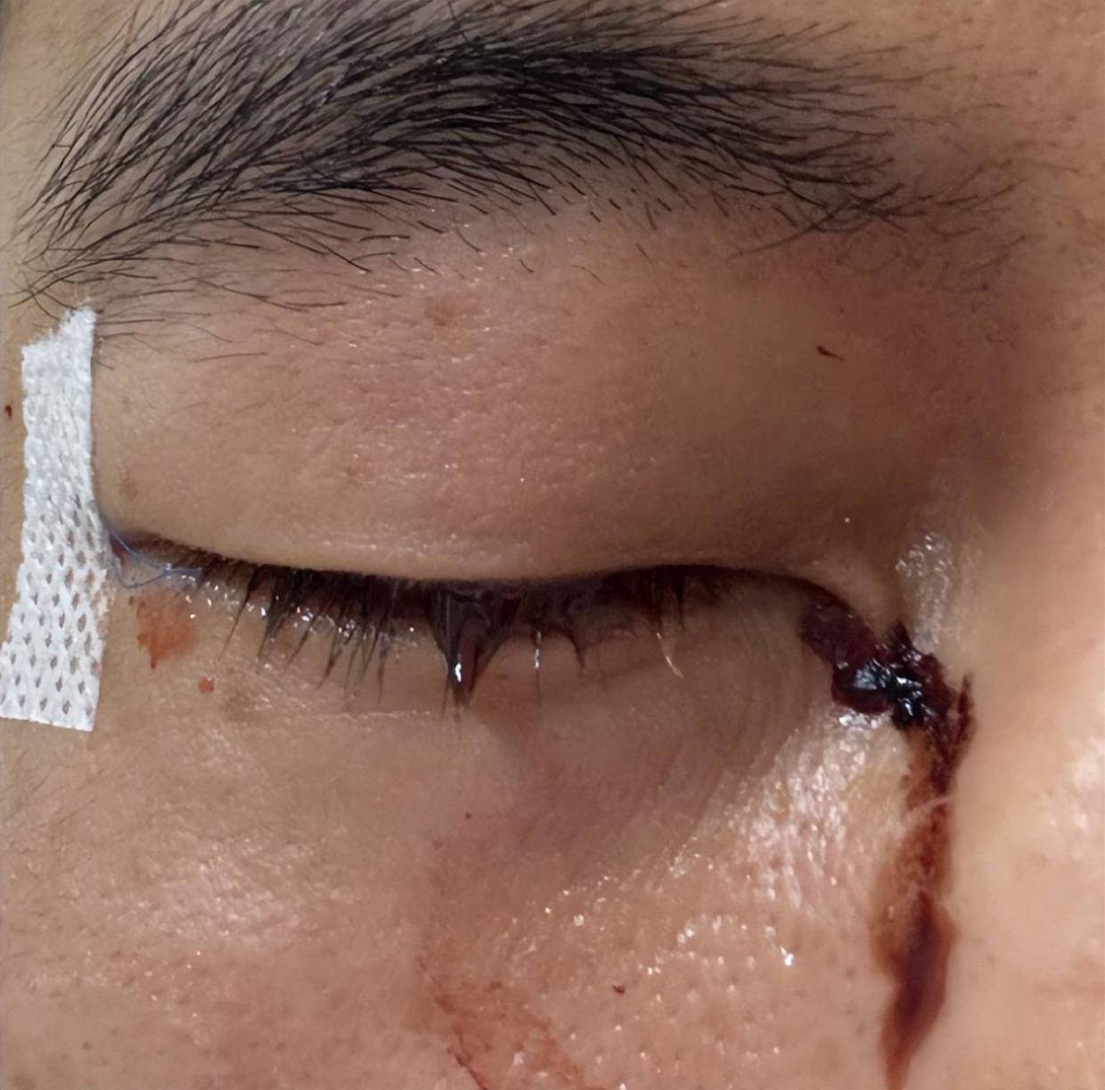 难学胡卫东！郭艾伦眼部重伤或能治愈 但职业生涯将彻底走下坡路