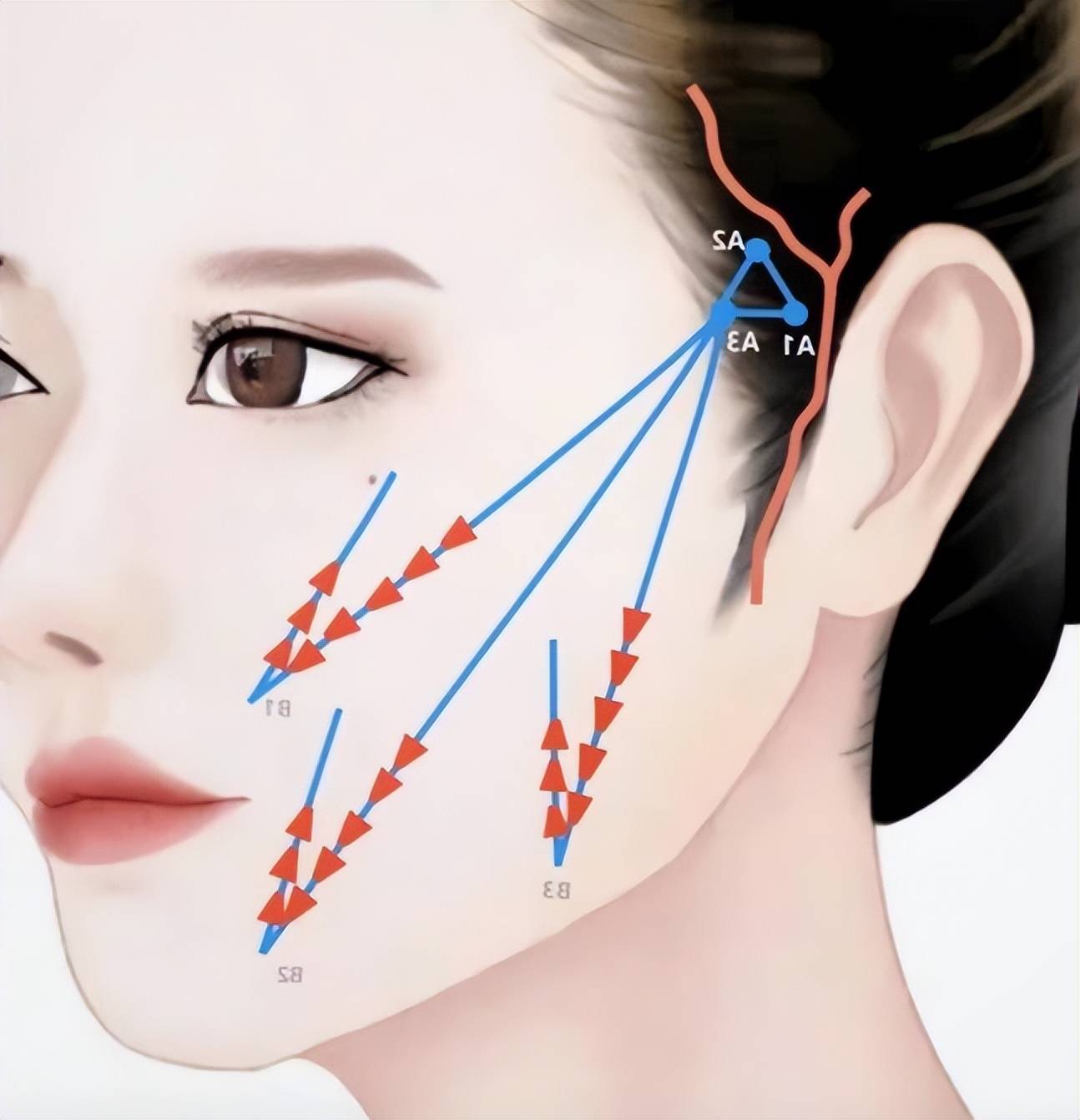 讲清楚不胡说大v线面部提升的原理是什么,大v线雕的危害都有哪些