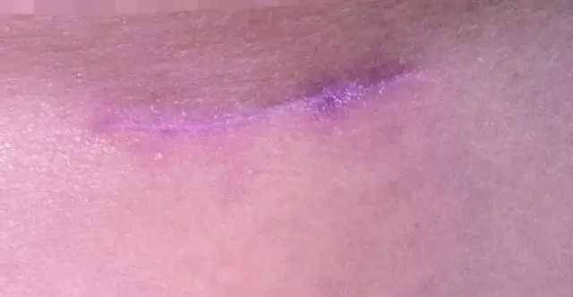 台州维多利亚被指注射致眼部变形:机构曾身陷套路贷风波(图7)