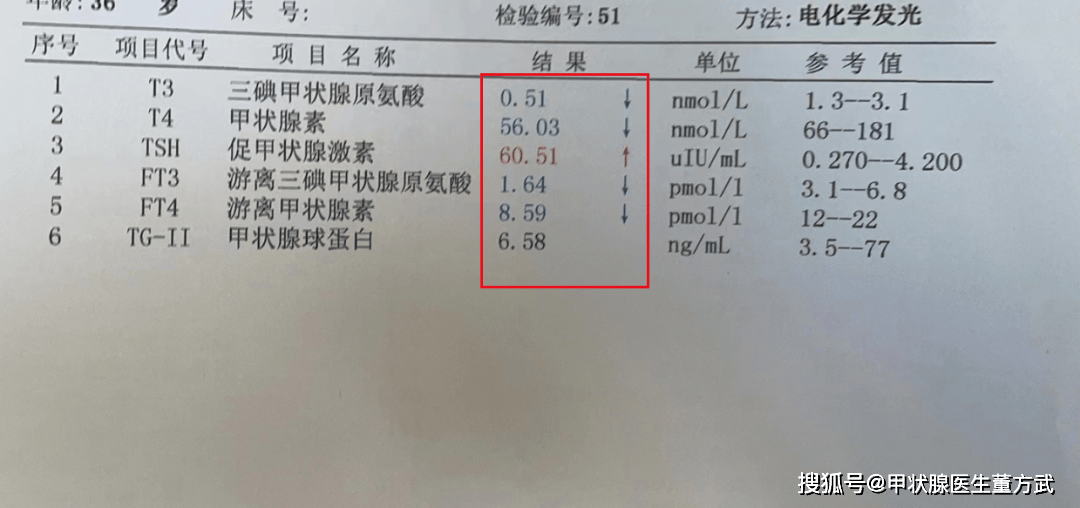 甲减患病率惊人！女性高发，症状早期难察觉，一文带你了解