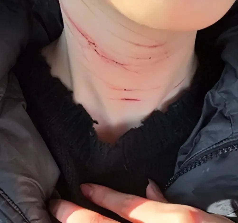 为了加强可信度,他还晒出了金赛纶脖部有伤痕的照片,暗示她曾遭受丈夫