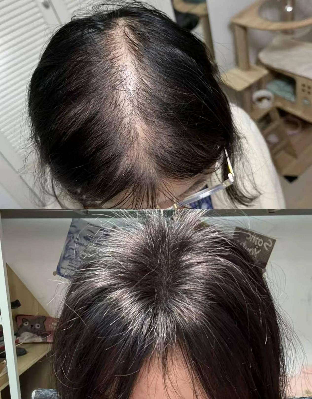 口碑好的防脱洗发水推荐