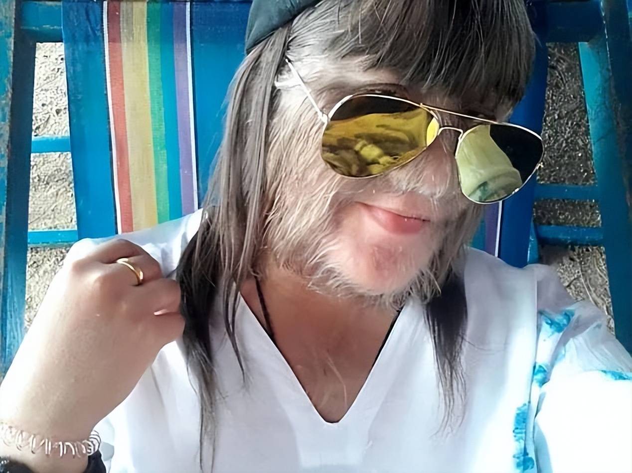 多毛女孩剃光胡子, 终结七年婚姻, 公开新恋情?这次,她转向了