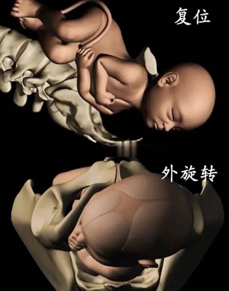 7张高清图带你了解顺产全过程,隔着屏幕都觉得疼,宝宝也很努力