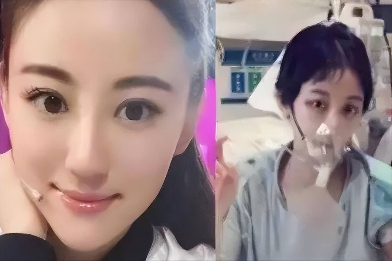 演员徐婷:一人养全家8口,26岁患癌遇伪中医,全身感染不治而亡