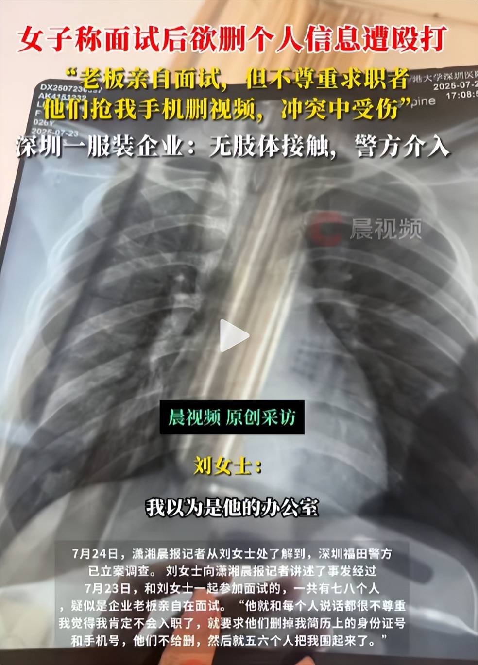 女子应聘被打骨折后续：警方立案调查，更多受害者哭诉遭遇！_搜狐网