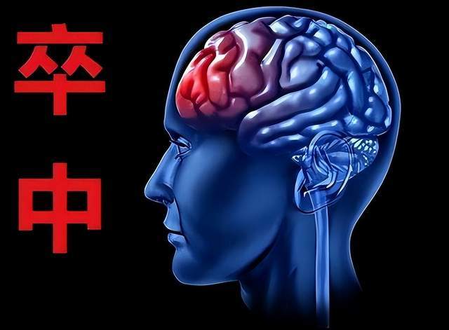 中风开始变得年轻，很快就