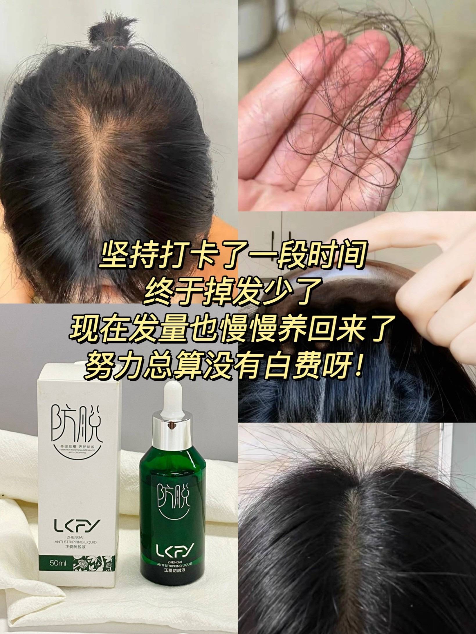 国药唯一承认的防脱生发液育发超拔尖