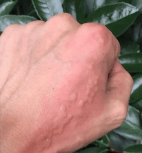 地"反击"只要轻轻一碰,布满了带毒的枝刺,这些小家伙体表也叫"刺毛虫"