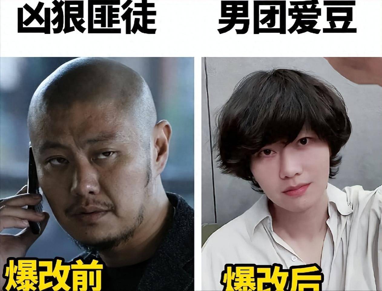 39岁的赵荀,从李二牛爆改成花美男,他的骨盆用3颗钉子挂在腰上
