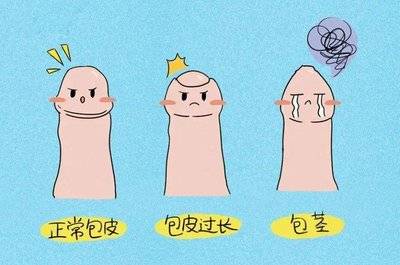 寒假“丁丁保卫战”：邯郸燕赵割包皮，这5类男孩最好别犹豫！