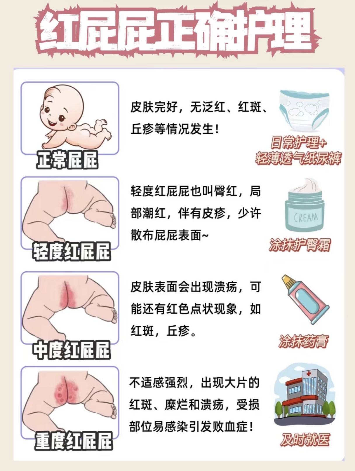 宝宝红屁屁怎么护理？纯干货