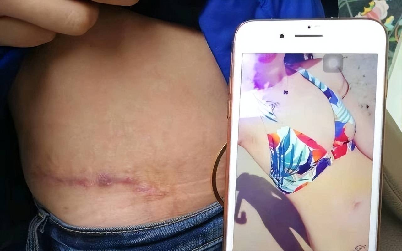 男子隆鼻后胸痛 西安路海军医疗被曝注册地址混同维权难(图13)