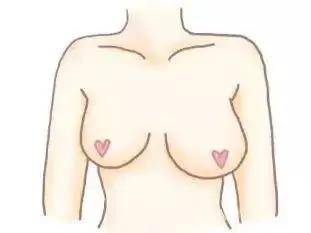 女性胸部为什么大小不一？如何改善尴尬的大小胸？