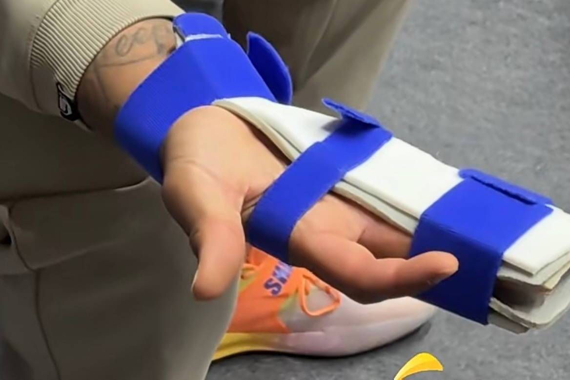 山东外援克里斯中指关节骨折 预计还需要两周康复