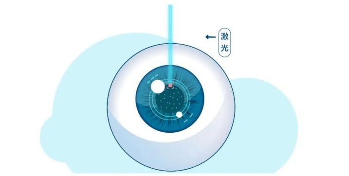 文章配图-2