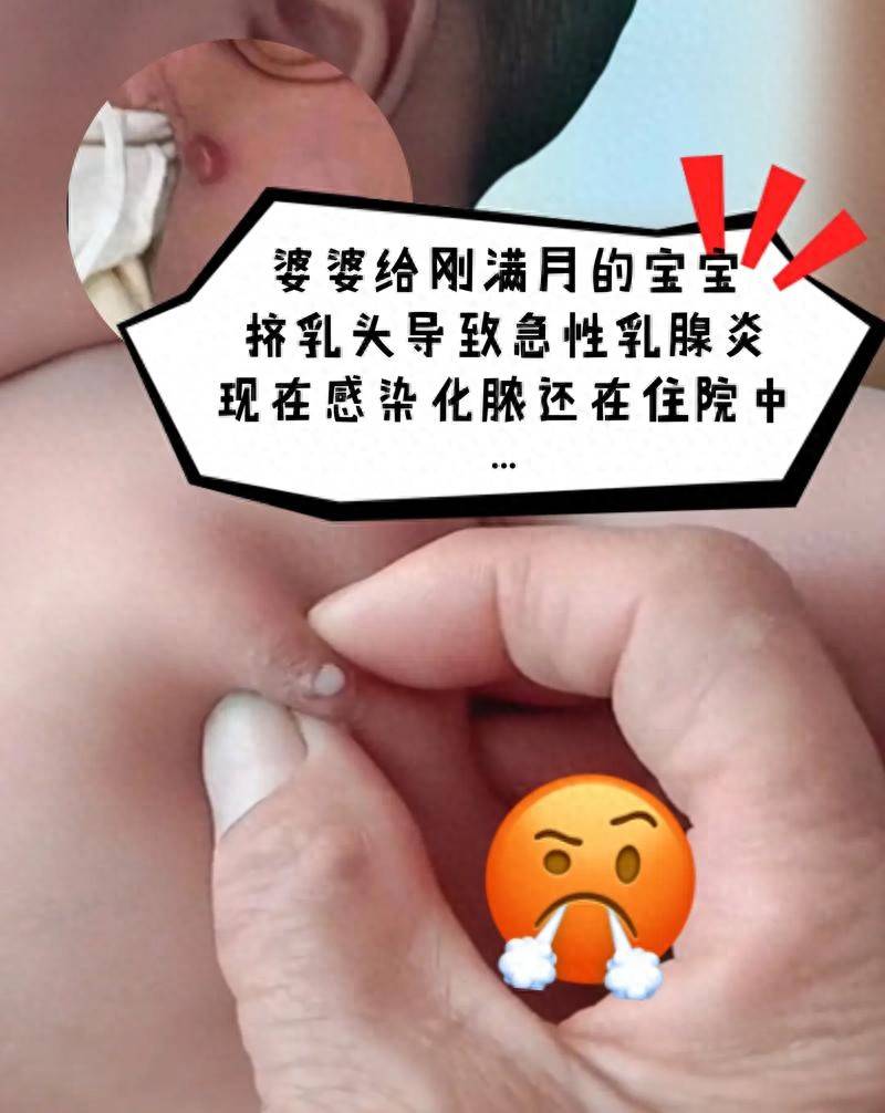 新生儿出现这7种“奇怪”现象，是正常的生理现象