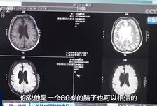 49岁男子长期熬夜刷手机，大脑萎缩如80岁！这些伤脑行为，你可能天天在做