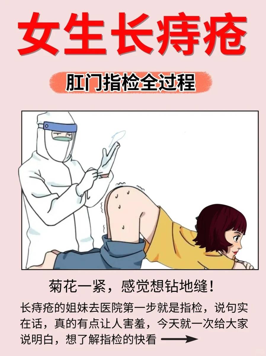 揭秘女生做肛门指检是一种什么体验