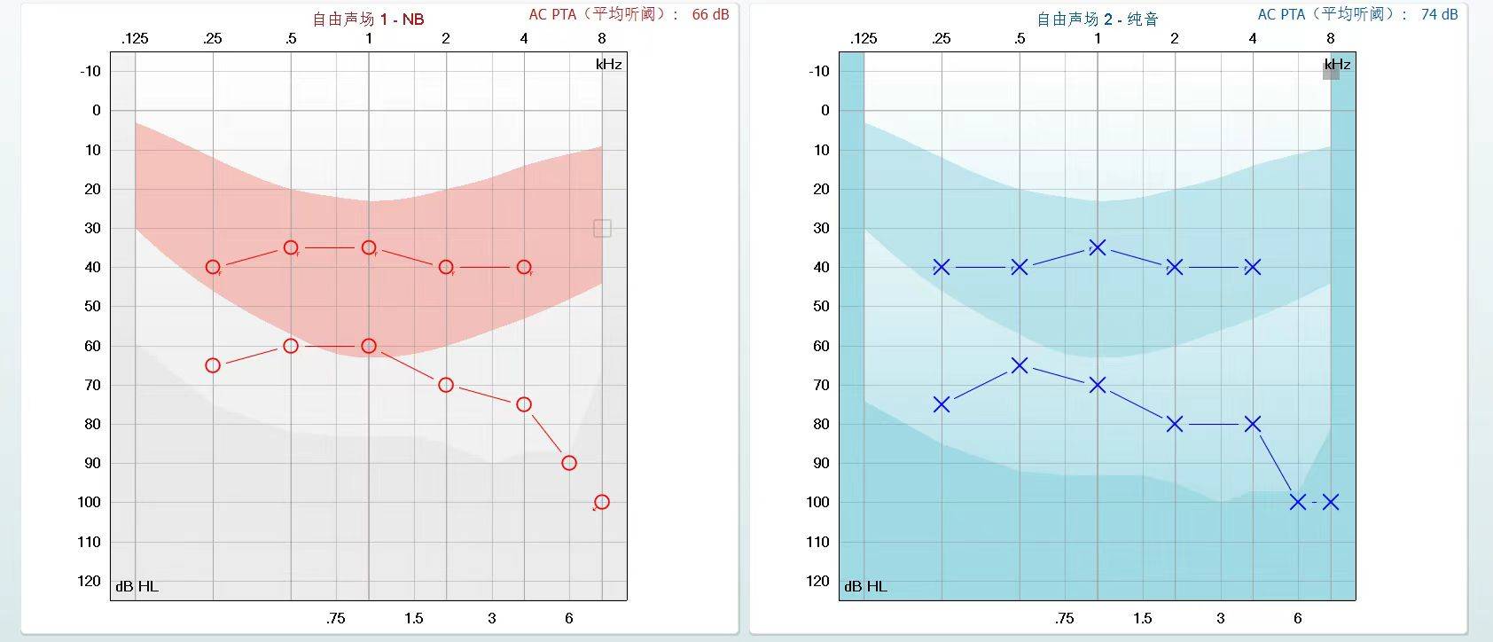 新神逸5300验配案例分享_助听器_老人_问题