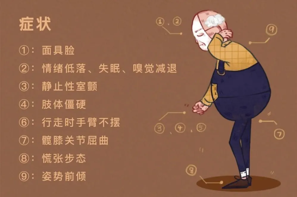 帕金森病最典型的症状包括静止性震颤,运动迟缓,肌强直和姿势平衡障碍