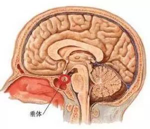 脑垂体瘤图片位置图片