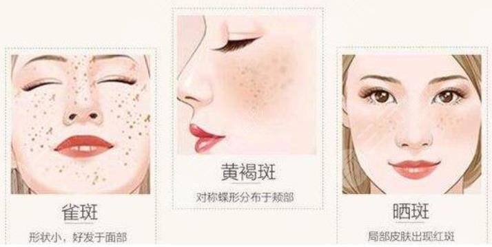 万黛摩颜-3个步骤淡斑,祛斑……不难_肌肤_皮肤_黑色素