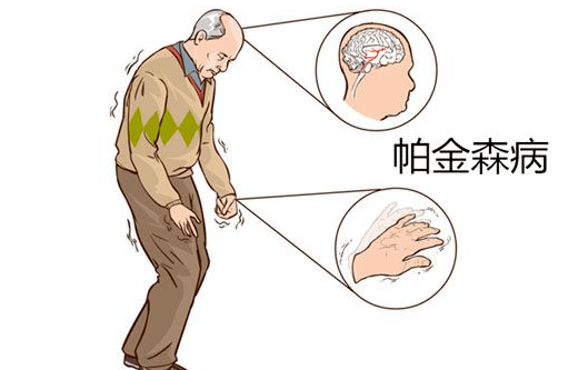 变性_治疗_药物