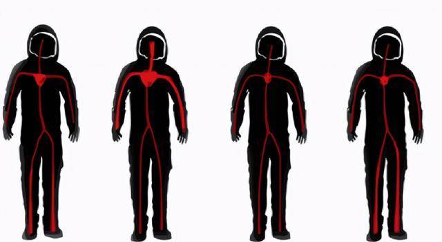 情况,可能是由于长期处于失重状态下,宇航员大脑脑脊液的分布被改变了