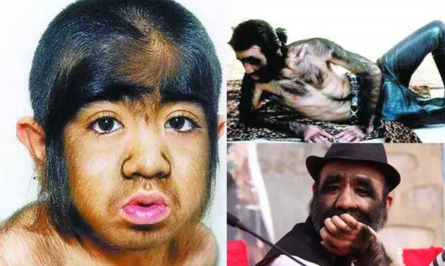 原创刚出生就被研究的于震寰有人花1000万包装他42岁娶90后娇妻