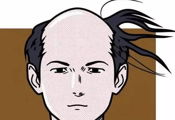 男女显示情况不同,男性患者主要从前额两侧头发开始变稀疏,变细,可以