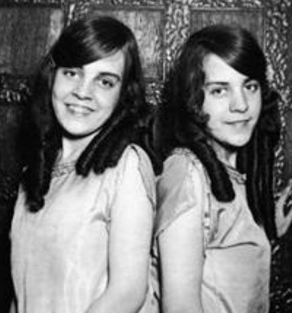 原创英国双胞胎姐妹臀部相连医生预言活不过一个月后来双双结婚了