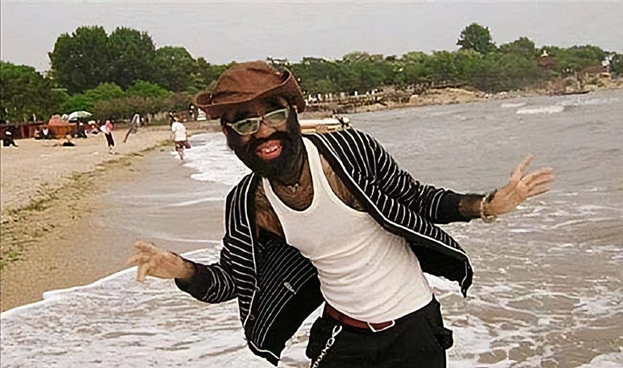 原创当年轰动一时的毛孩42岁娶90后娇妻生下一子未遗传长毛