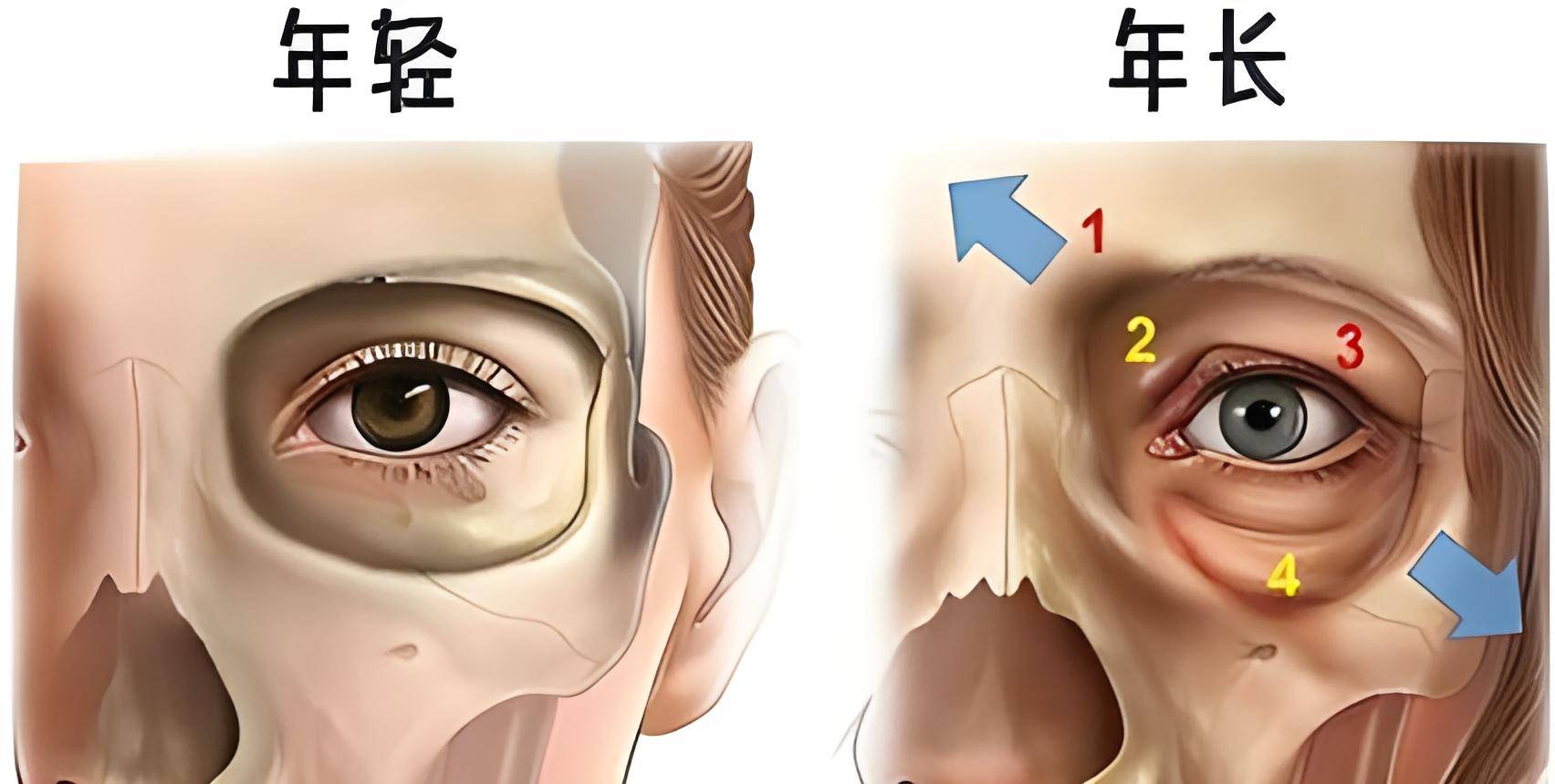 脸部骨头突出图片