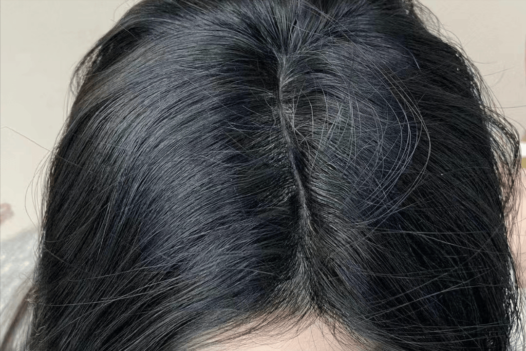 头发_头皮_产品