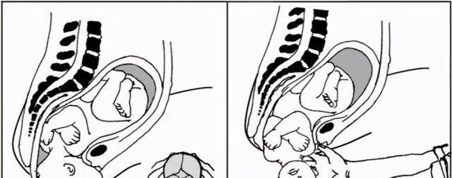 原创人类都是早产儿科学家提出怀孕21个月才足月这种说法靠谱不