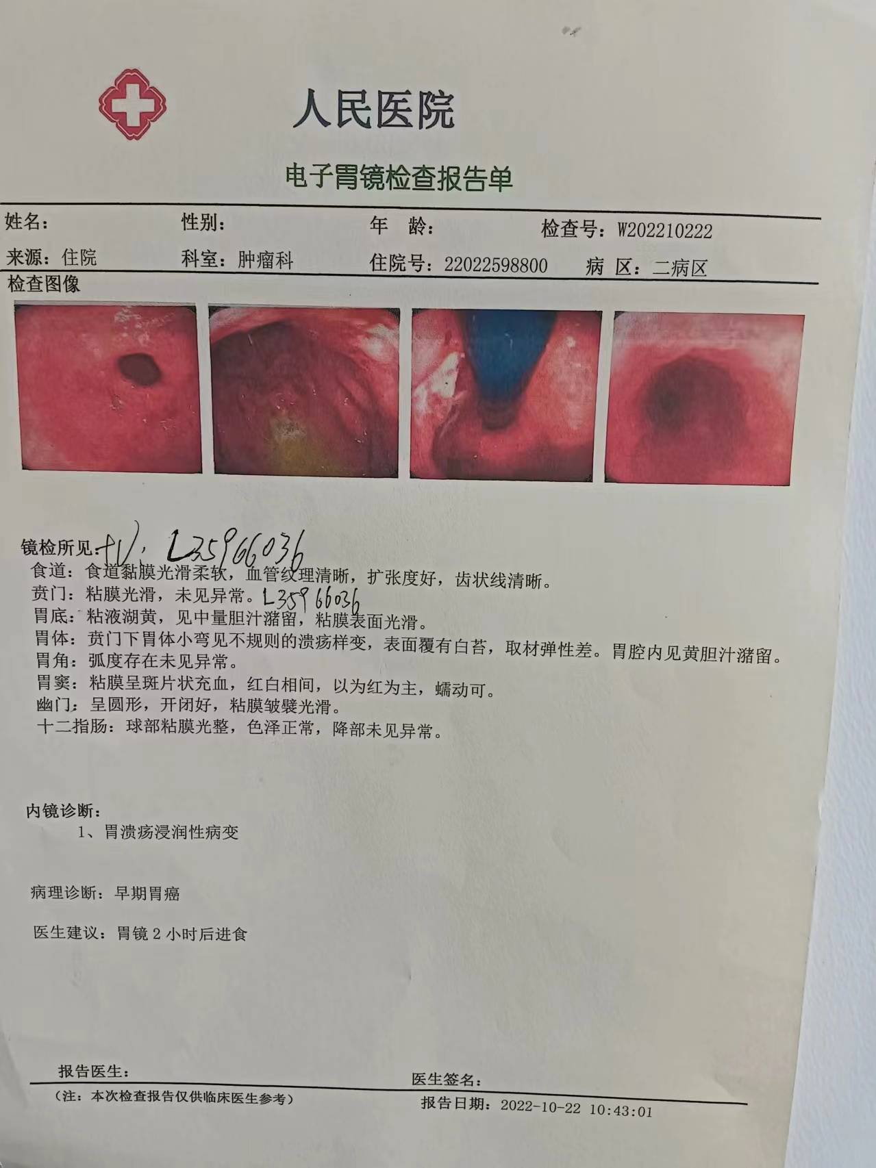 怀孕了b超单怎么看呢?