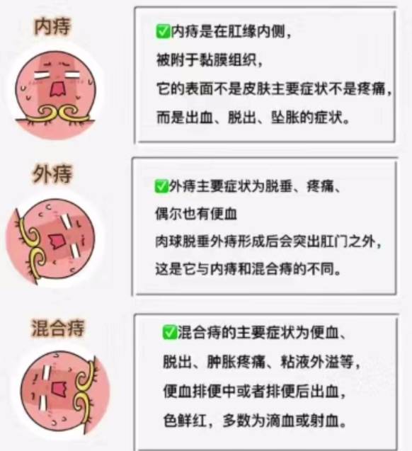 外痔和内痔有什么区别图片