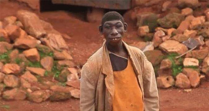 非洲男孩艾力:长相返祖酷似猿猴,以水果为食物,一周跑230公里