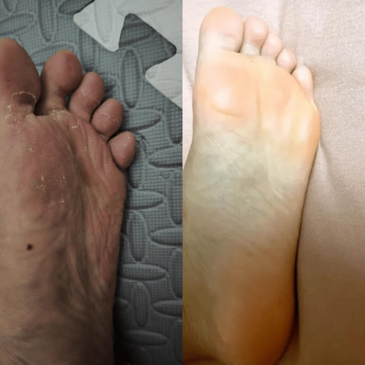 性价比高还管用的脚气产品都在这里了,还不赶紧来看!