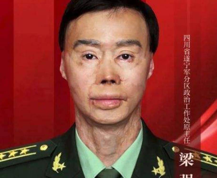 1995年,兵哥哥梁强为救27名乘客重度烧伤,女友始终不离不弃