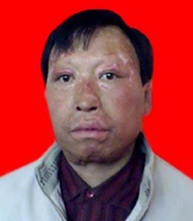 他为救老板儿子被烧成"焦人",老板却远遁他乡,10年后真相感人