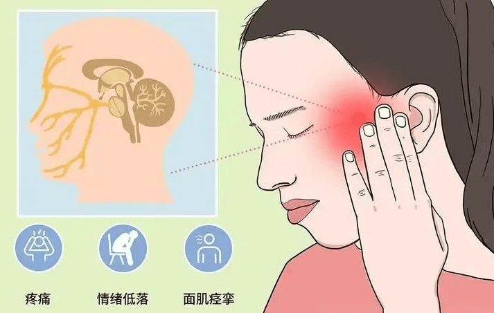 三叉神经痛的症状图片