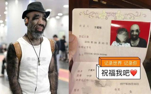 刚出生就被研究的于震寰:有人花1000万包装他,42岁娶90后娇妻