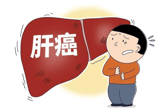 为什么肝癌晚期才发现?医生:身体若有7大异常,建议做肝ct筛查