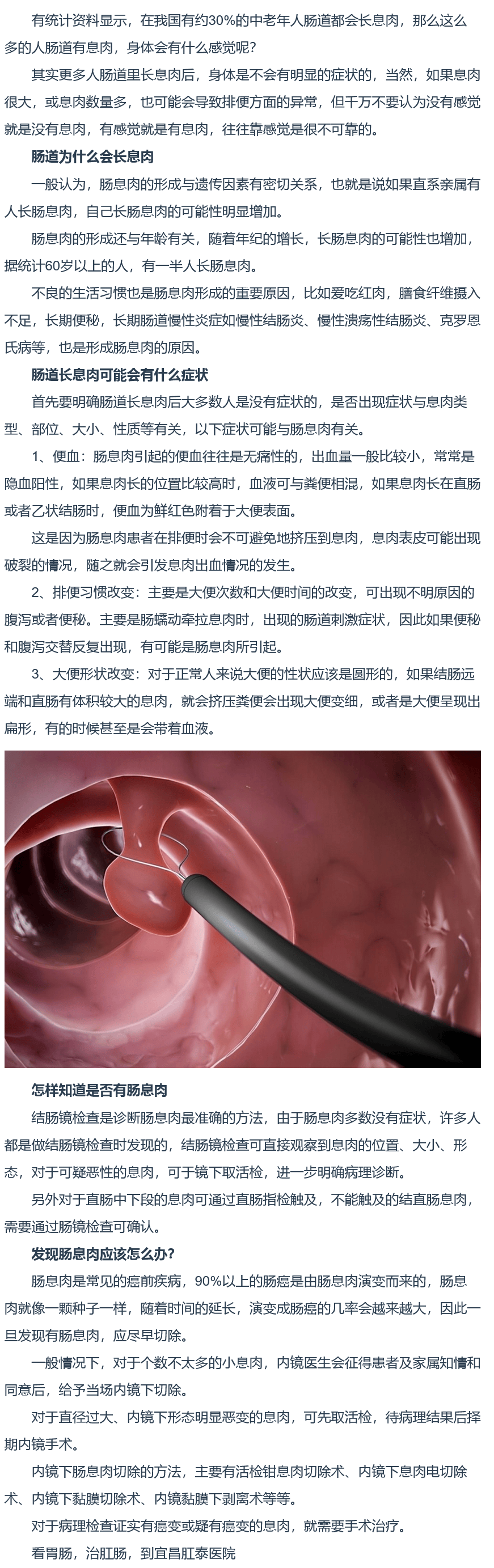 肠息肉检查报告图片