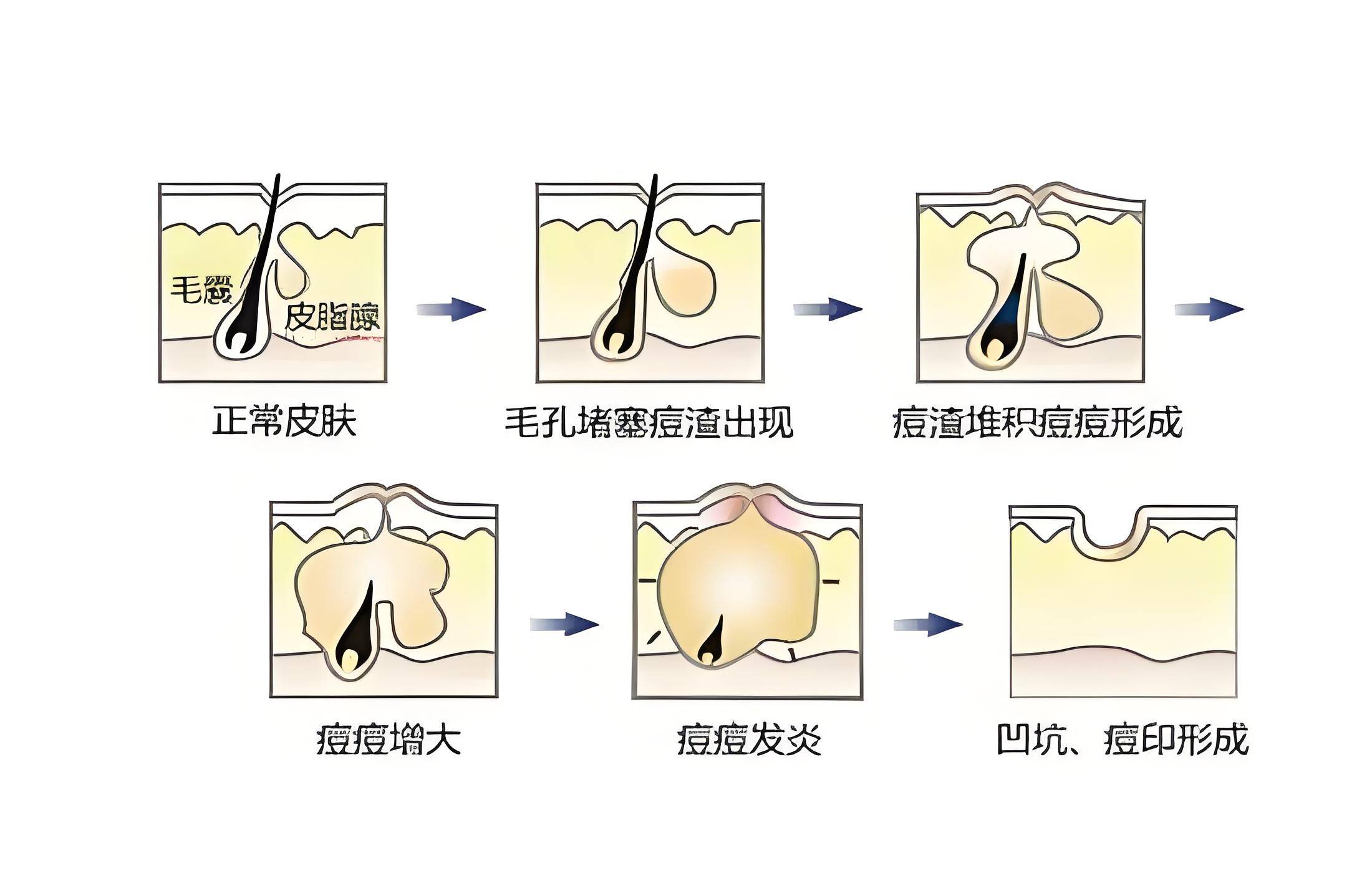 炎症