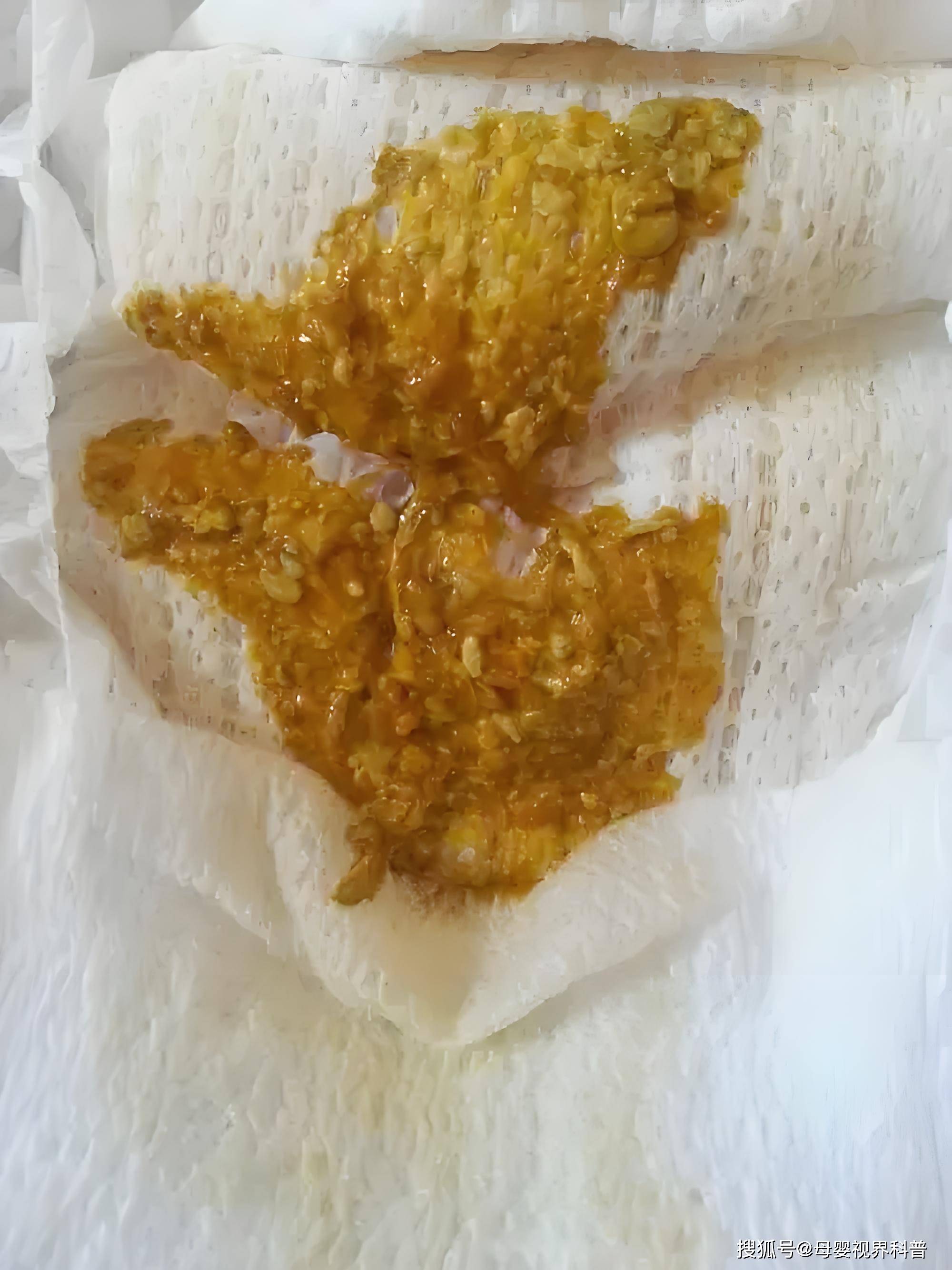 母婴视界:宝宝大便有奶瓣怎么办?