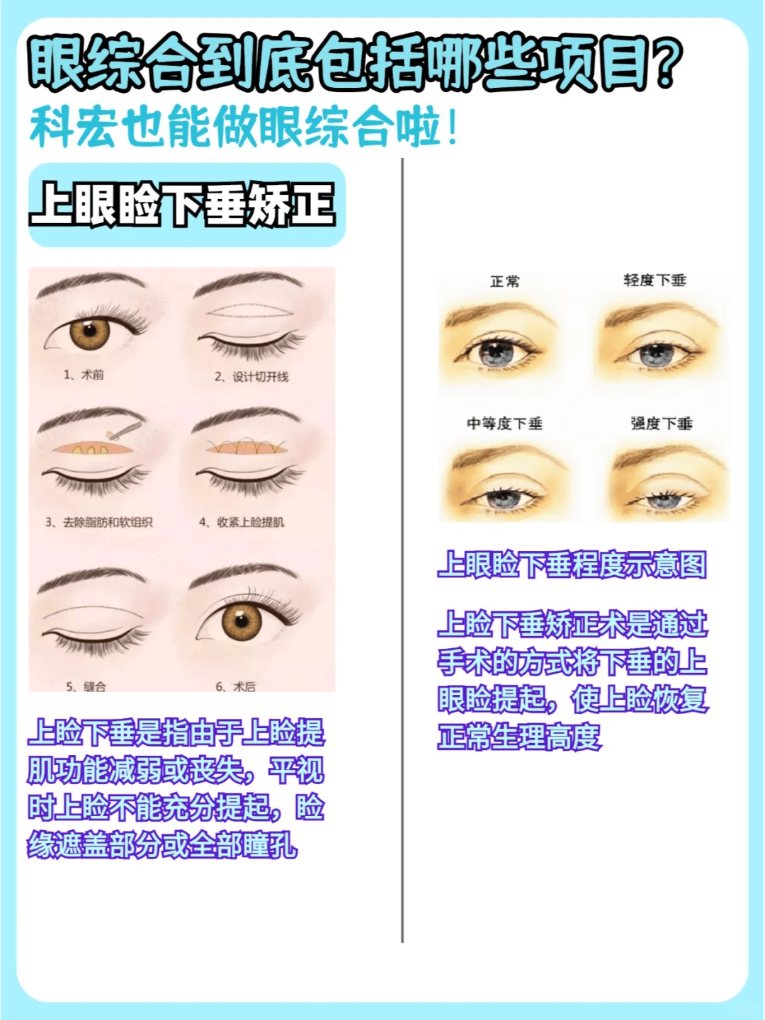 眼综合包括哪些项目?科宏也能做眼综合啦?